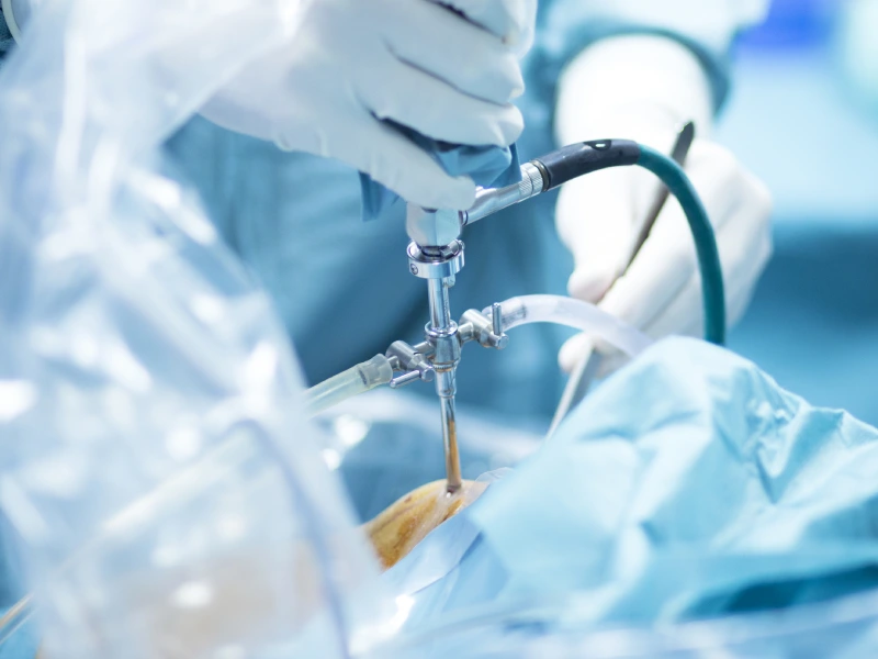 آرتروسکوپی چیست و چه کاربردهایی دارد؟