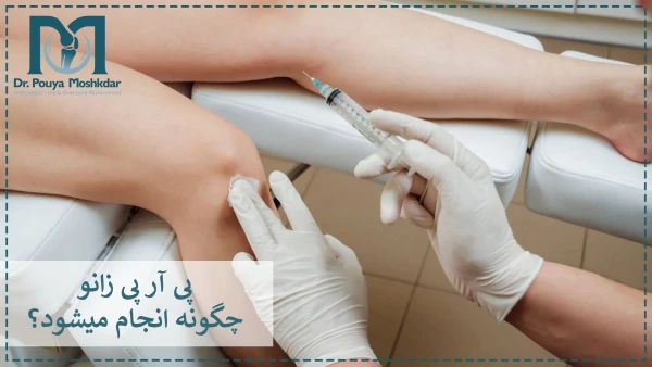 پی آر پی زانو چگونه انجام میشود؟