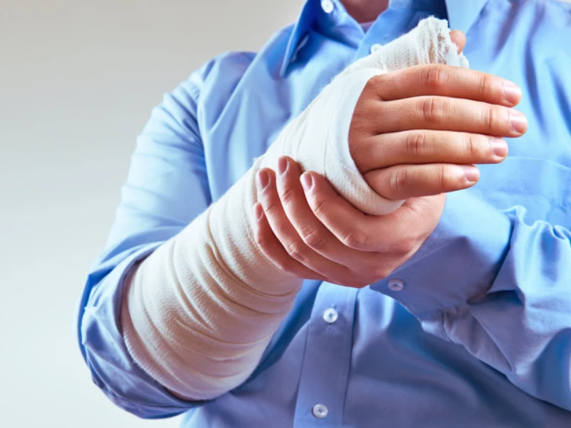 شکستگی استخوان