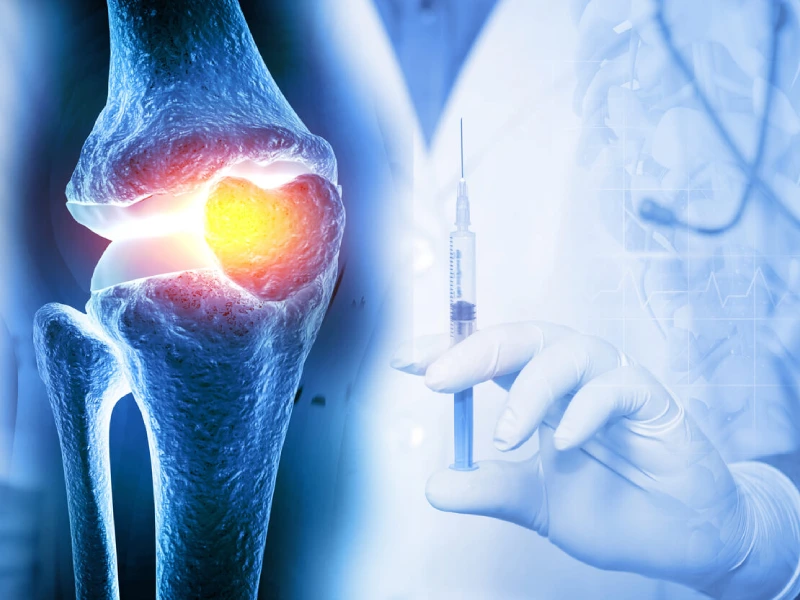 پی آر پی زانو