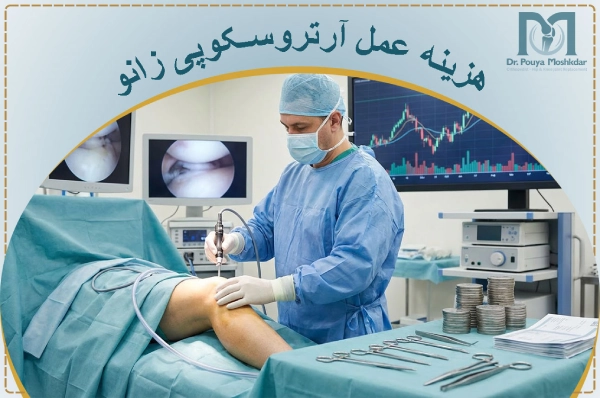 هزینه عمل آرتروسکوپی زانو