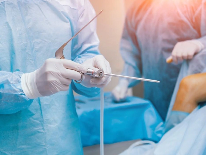 بهترین دکتر آرتروسکوپی در تهران