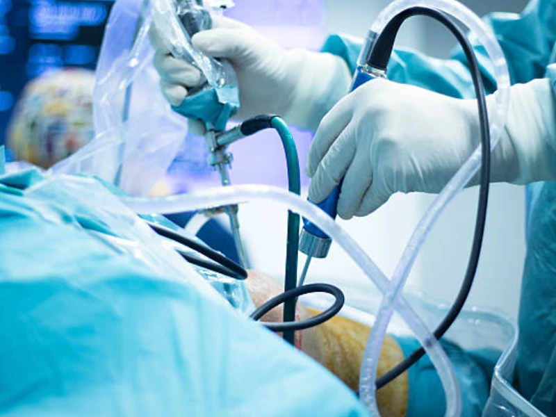 آرتروسکوپی لگن یا هیپ