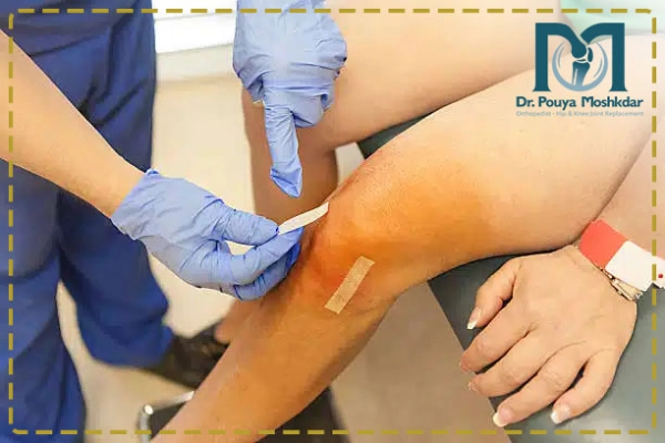 آرتروسکوپی زانو چیست؟