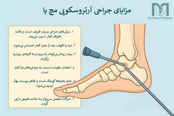 مزایای عمل جراحی آرتروسکوپی مچ پا