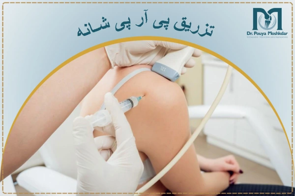 تزریق پی آر پی شانه