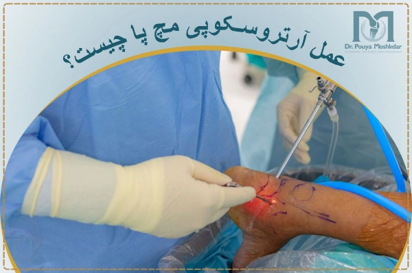 عمل آرتروسکوپی مچ پا چیست؟