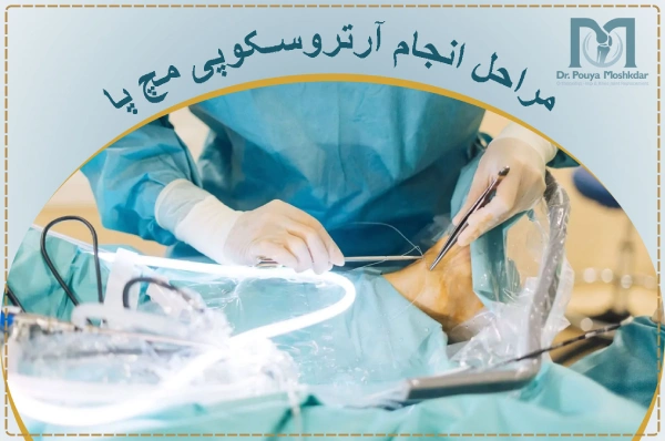 مراحل انجام آرتروسکوپی مچ پا