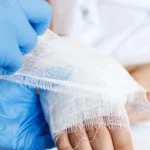 آرتروسکوپی مچ دست