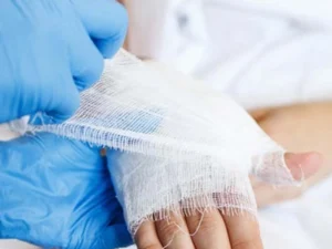 آرتروسکوپی مچ دست