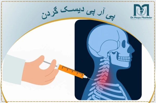 پی آر پی دیسک گردن