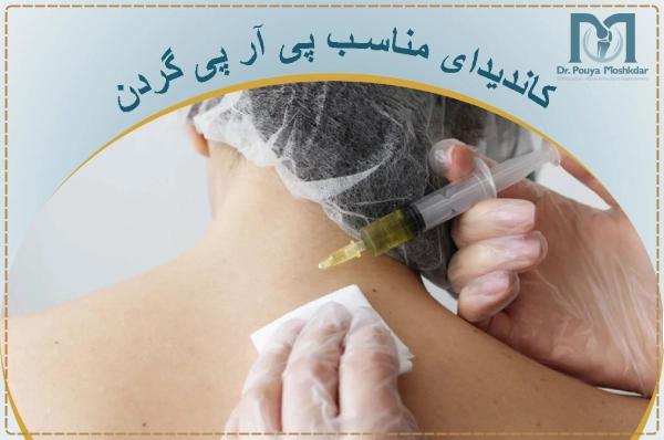 کاندیدای مناسب پی آر پی گردن