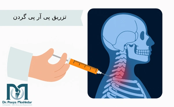 پی آر پی دیسک گردن