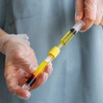 فواید پی آر پی کمر و ستون فقرات