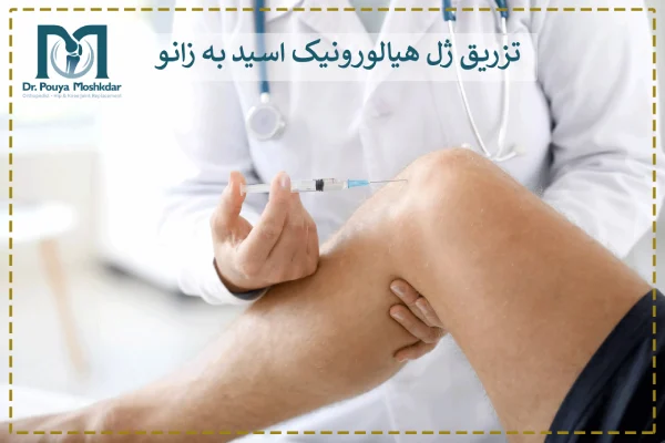 تزریق ژل هیالورونیک اسید به زانو