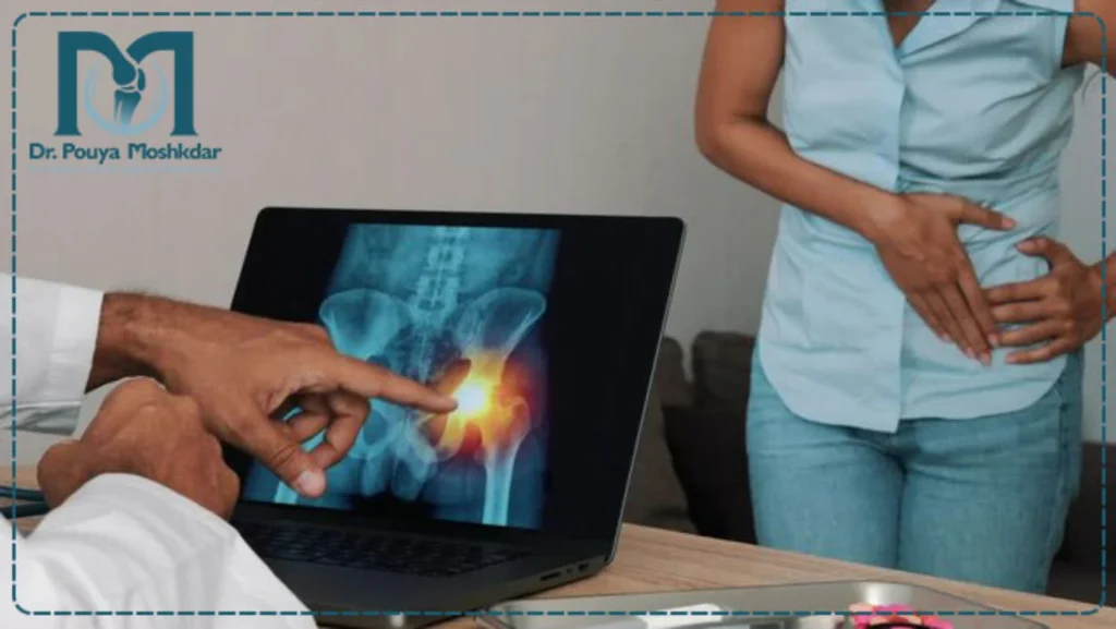 روشهای تشخیص شکستگی لگن