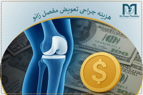 هزینه جراحی تعویض مفصل زانو