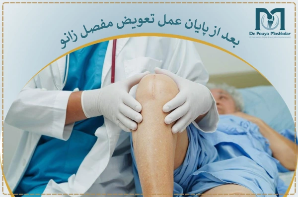 بعد از پایان عمل تعویض مفصل زانو