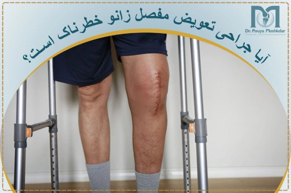 آیا عمل تعویض مفصل زانو خطرناک است؟