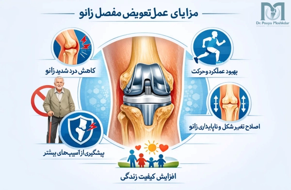 مزایای عمل تعویض مفصل زانو