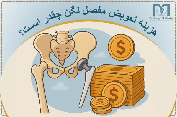 هزینه جراحی تعویض مفصل لگن چقدر است؟