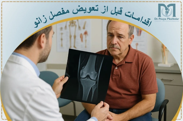 امادگی قبل از تعویض مفصل زانو