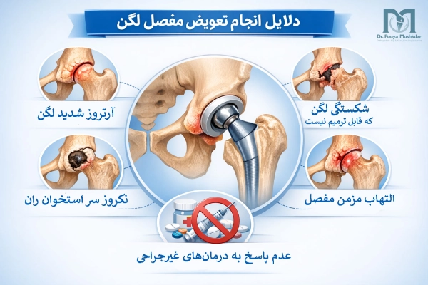دلایل انجام تعویض مفصل لگن
