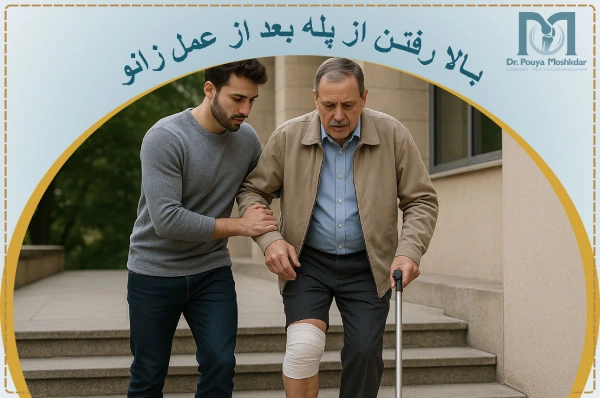 بالا رفتن از پله بعد از عمل تعویض مفصل زانو