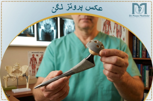 عکس تعویض مفصل لگن