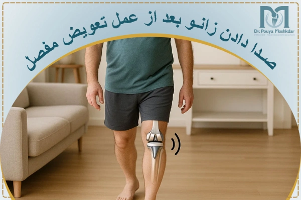 صدا دادن زانو بعد از عمل تعویض مفصل علت