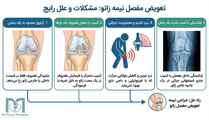 کاربرد تعویض مفصل نیمه زانو